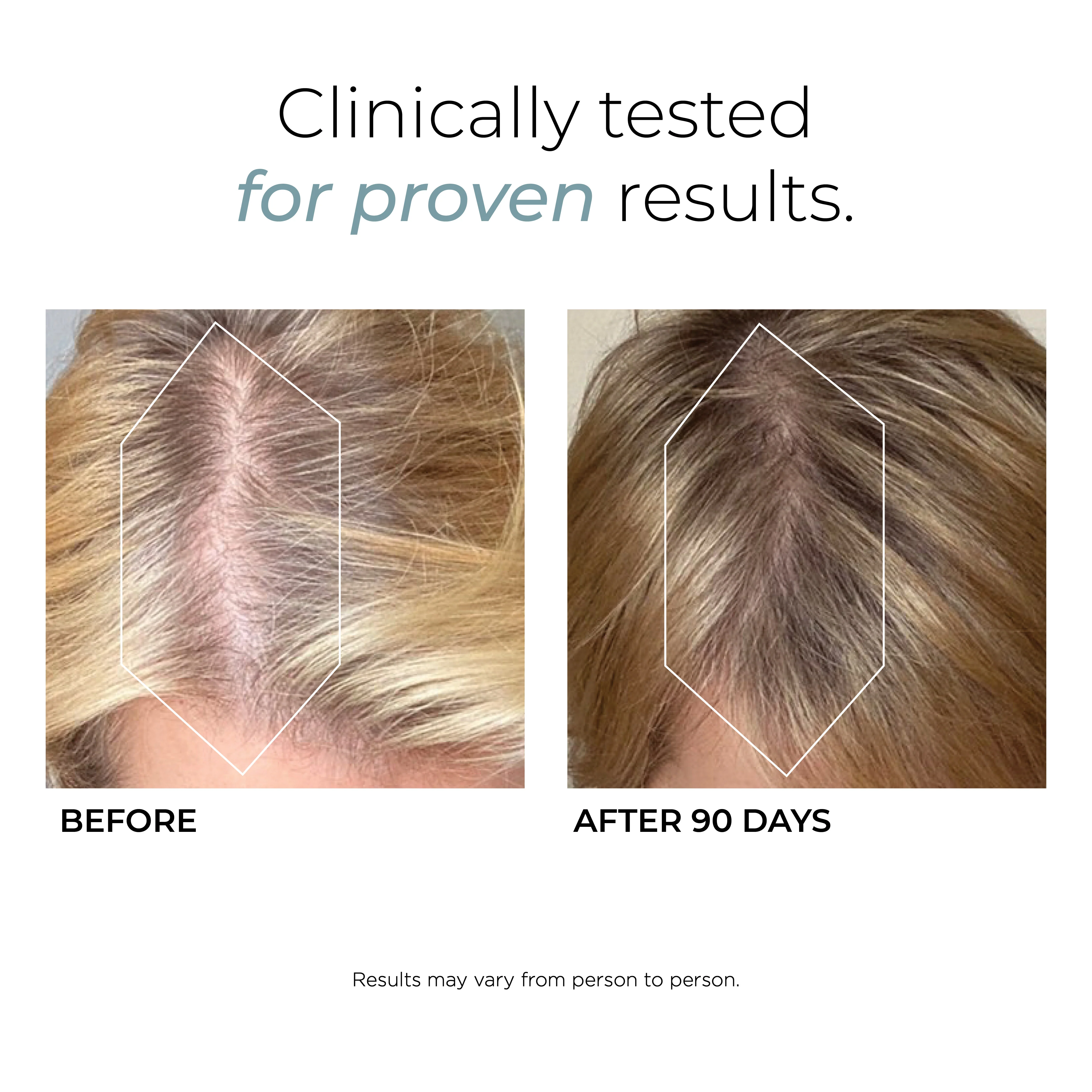 Best Sellers Duo - Image 4